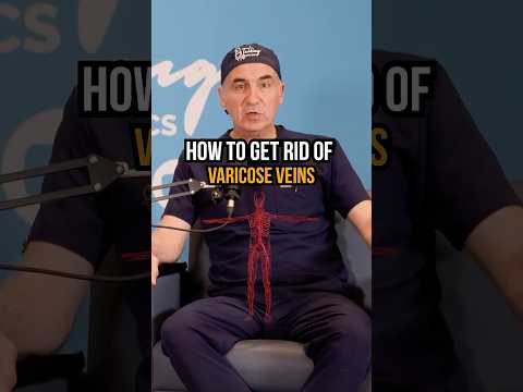 Can You Really Prevent Varicose Veins?