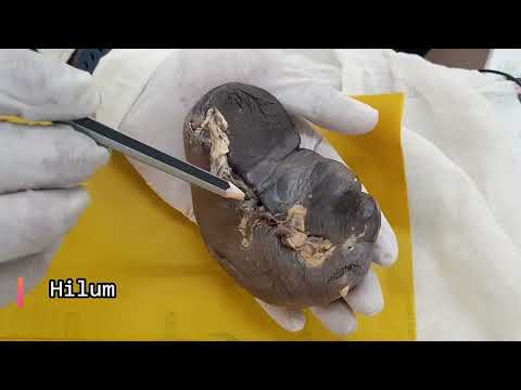 Spleen | Anatomical Position  | Parts | Relations | Applied Anatomy