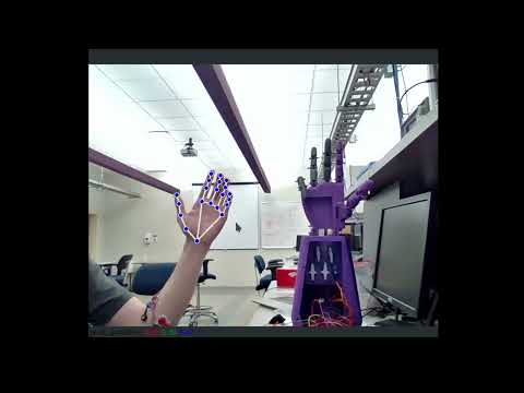 NBI EMG Prosthetic Hand