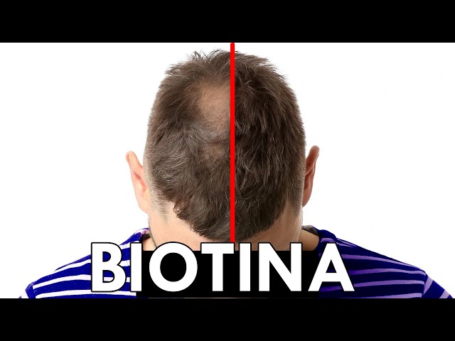 Vídeo relacionado con JOHN FRIEDA - Spray Densificador Profiller 150 ml, para Cabellos Finos y Débiles, Fortalece y Densifica, con Biotina y Ácido Hialurónico, Ayuda a Reducir Caída de Cabello Dañado, Protección Térmica