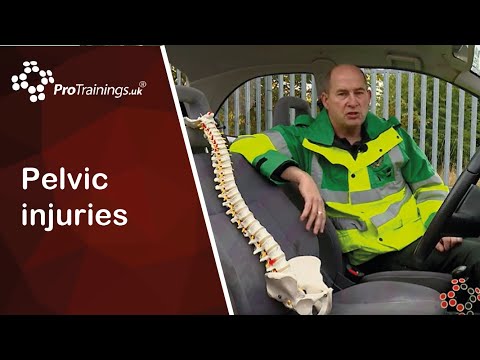 Pelvic injuries