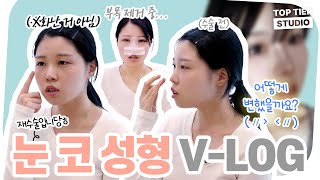 [눈‧코 성형 리얼후기 브이로그] 자연스럽게 아이돌 느낌으로 변신!✨[1편]ㅣ탑티어성형외과