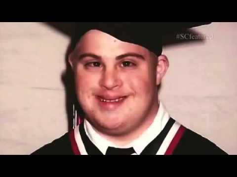 My Shocking Story   A Fighter with Down Syndrome ASHPIDYTU