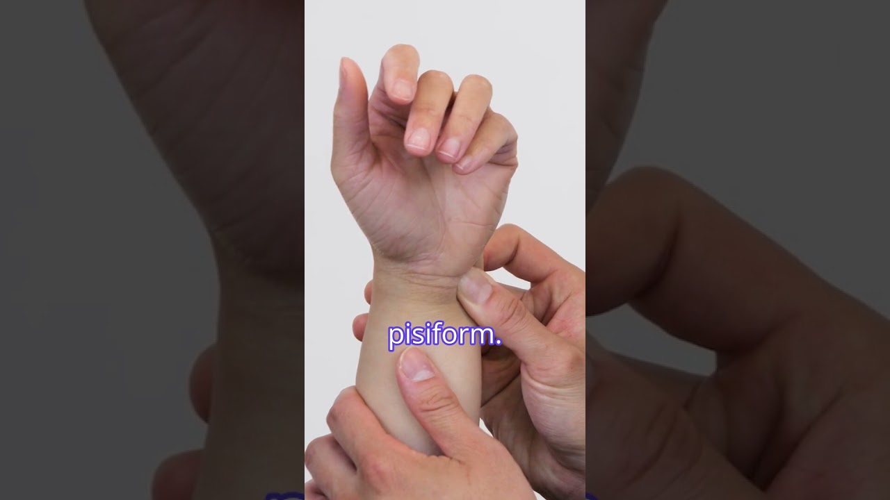Ulnar Fovea Sign: Pinpointing Ulnar-Sided Wrist Pain