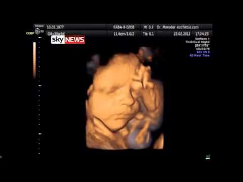 Unborn Babies 'Yawn Repeatedly Inside Womb'