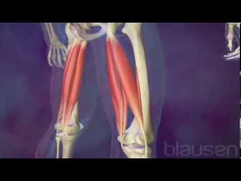 comment guerir une dechirure musculaire a la cuisse