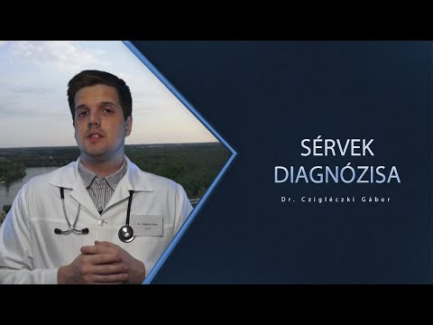 hogy merevedés legyen, amihez tenni kell