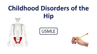 Childhood Disorders of the Hip Made Super Easy
