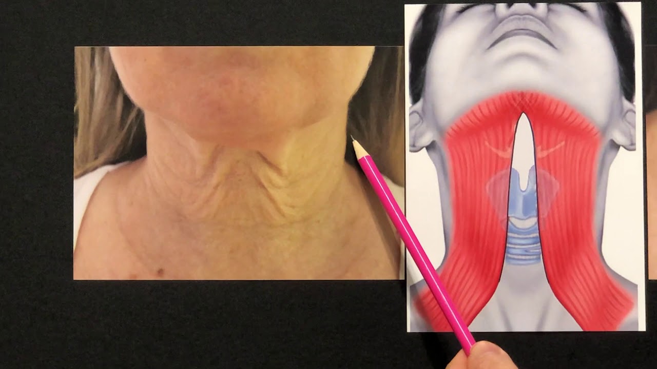 Ringiovanimento Collo - Dott. Antonio Distefano