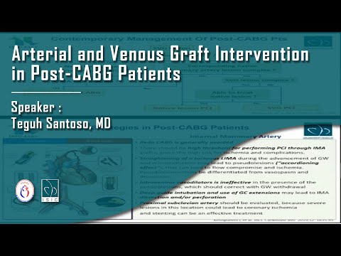 Arterial and Venous Graft Intervention in Post CABG Patients