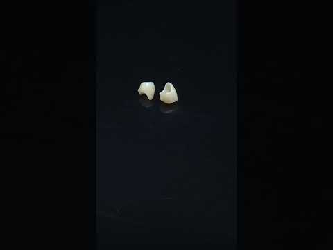YouTube 썸네일