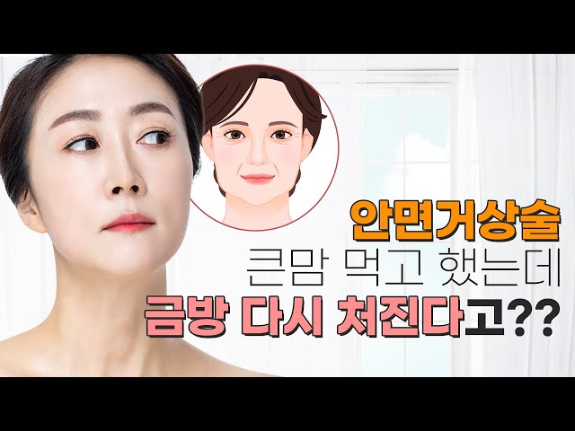 안양 스페셜성형외과_스페셜 TV_안면거상 안양 스페셜성형외과_스페셜 Tv_안면거상