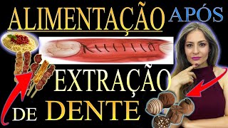 EXTRAI um Dente, o que posso COMER Saiba o que comer após uma extração de dente do siso