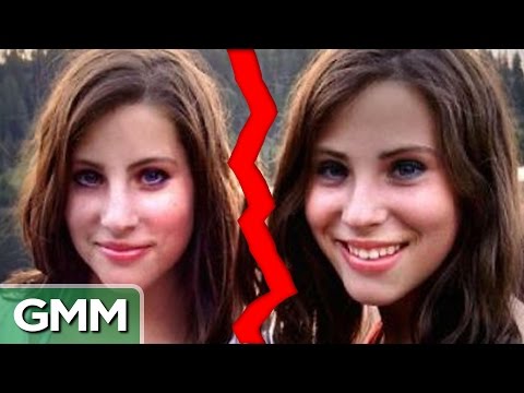 Shocking Parallels of Separated Twins