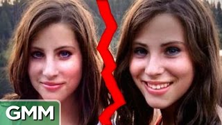 Shocking Parallels of Separated Twins