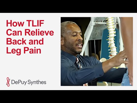 Transforaminal Lumbar Interbody Fusion (TLIF) Explained: From Surgery to Recovery | DePuy Synthes