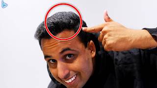 How I Fixed the Headphone Dent in My Head (Gamer Dent)