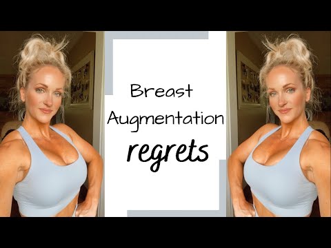 Breast Augmentation Q & A | Regrets??