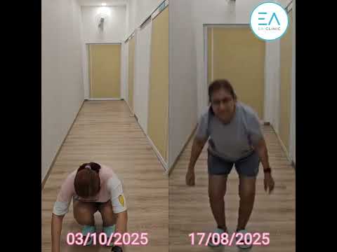 Knee PRP - Before & After