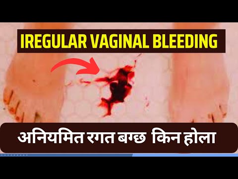 Abnormal vaginal Bleeding cause & Treatment In Nepali || अनियमित पाठेघरबाट रगत बग्ने समस्या र उपचार
