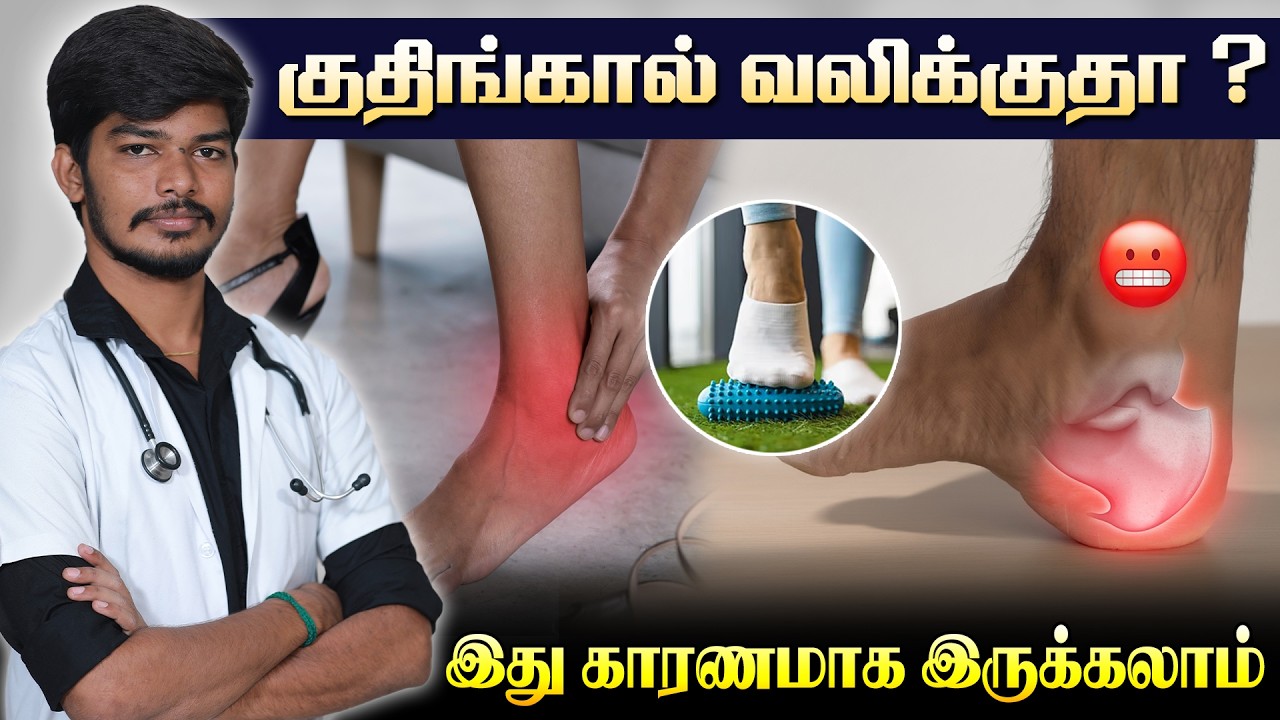 குதிங்கால் வலிக்குதா ? இது காரணமாக இருக்கலாம் ! What is Plantar fasciitis? Risk factors and Symptoms