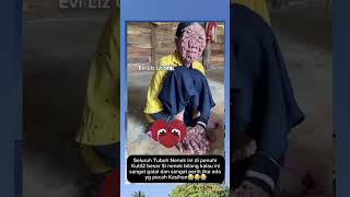 Download lagu his whole body is covered in warts #inspirationalstory #viralshort #fypviral mp3 Download lagu his whole body is covered in warts #inspirationalstory #viralshort #fypviral mp3
