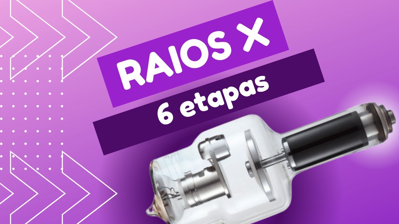 A PRODUÇÃO DE RAIOS X EM 6 ETAPAS [POR ACADEMIA DE RADIOLOGIA]
