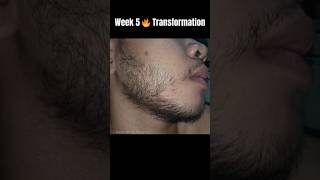 Download lagu Minoxidil Beard Transformation | Day 1 to Week 5 π₯ Real Growth Journey mp3 Download lagu Minoxidil Beard Transformation | Day 1 to Week 5 π₯ Real Growth Journey mp3