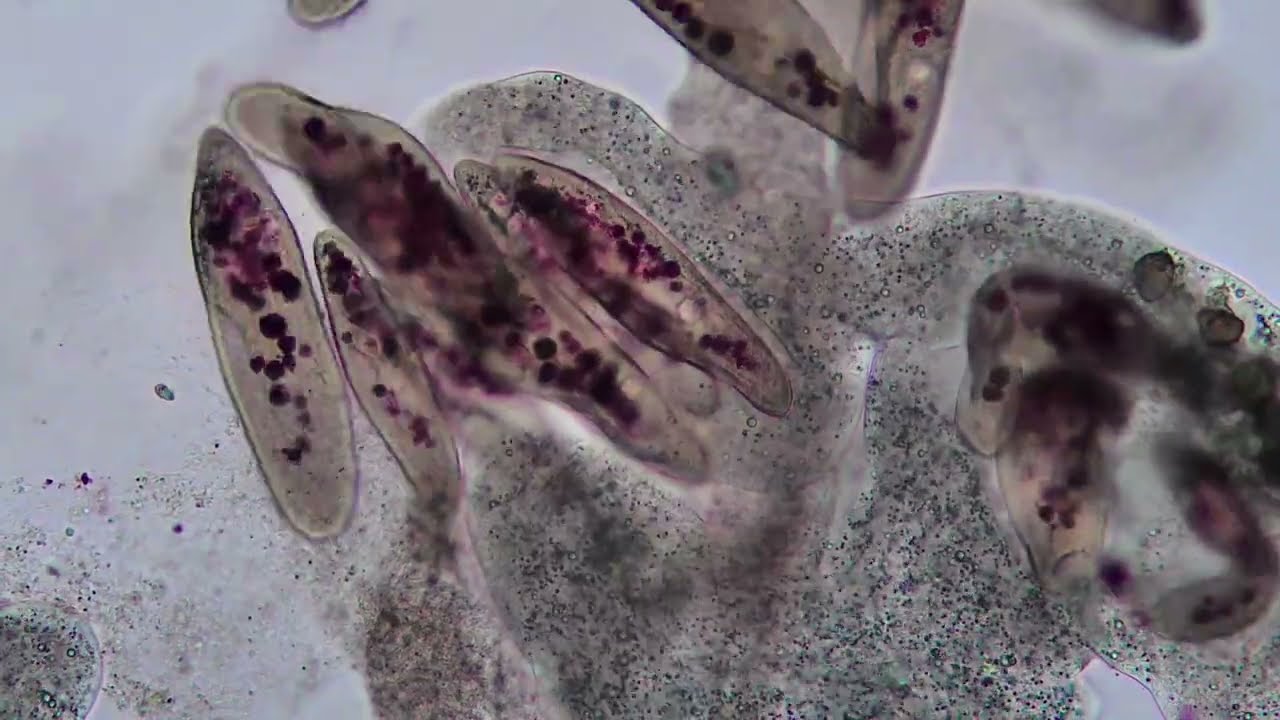 Amoeba in action... to cover song of 'A sky full of stars' by Coldplay