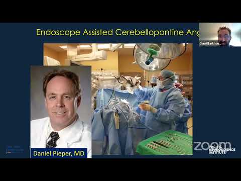 Endoscope Assisted Posterior Fossa Surgery