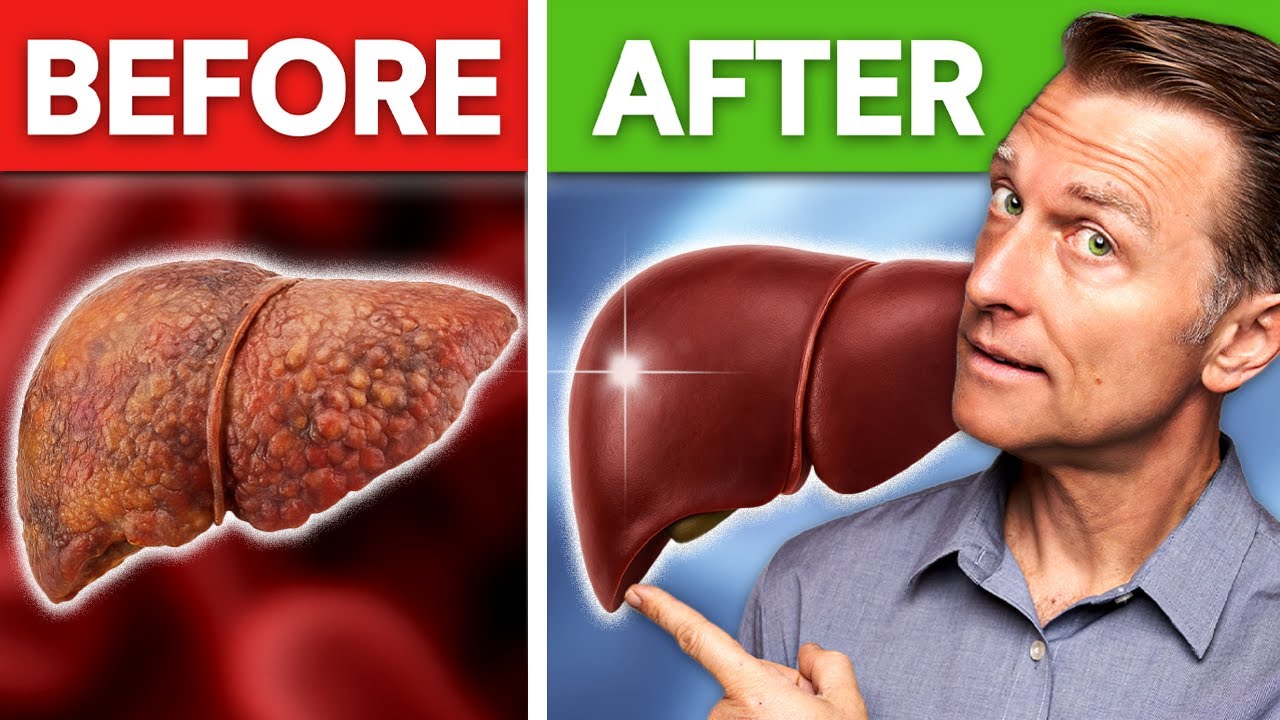 The #1 Best Way to CLEAN a Fatty Liver