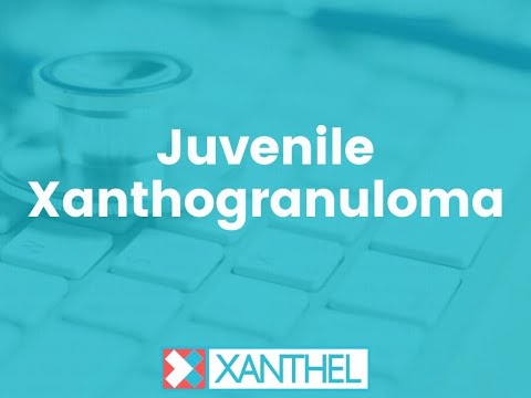 Juvenile Xanthogranuloma