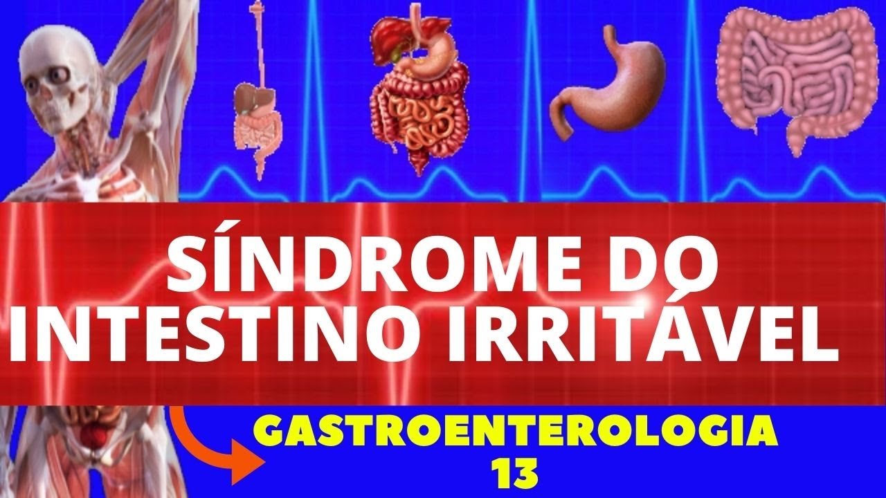 SÍNDROME DO INTESTINO IRRITÁVEL (CAUSAS, SINTOMAS, DIAGNÓSTICO E TRATAMENTO) - GASTROENTEROLOGIA
