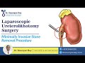 Watch Video Laparoscopic Ureterolithotomy Surgery Explained by Dr. Soumyan Dey