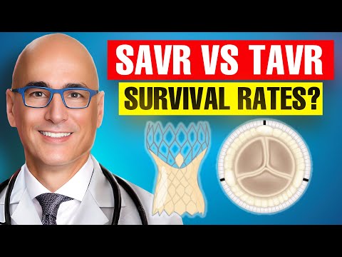 Surgical Versus Transcatheter Aortic Valve Replacement Survival in Patients Over 65 Years Old