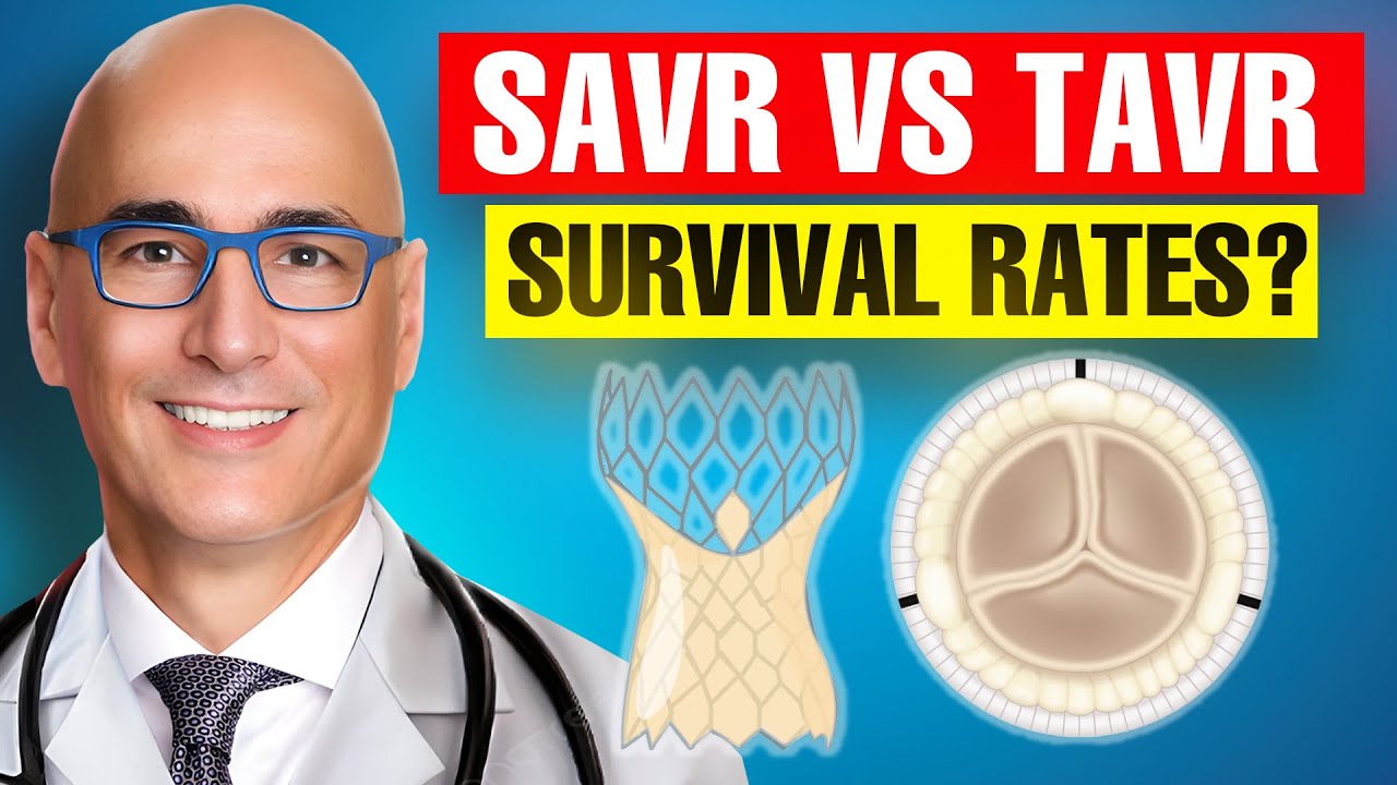 Surgical Versus Transcatheter Aortic Valve Replacement Survival in Patients Over 65 Years Old
