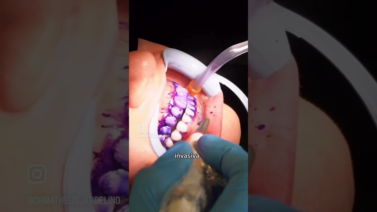 Matheus Jardelino Dias-11