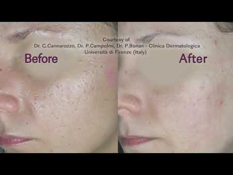 SmartXide2 - DEKA LASER