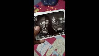 Download lagu baby family akustik story' wa terbaru .. mp3