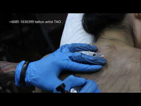 การผลิตของกลาก กลากในเด็กในผิวของภาพ