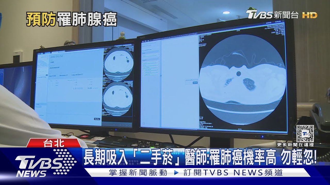 不吸菸...為何「罹肺癌」關鍵是「這原因」 醫:致死率高!
