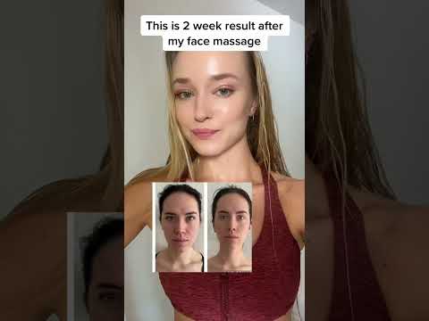 2 Week Face Massage Results (Client Before/After)