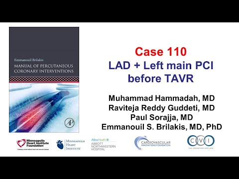 Case 110: PCI Manual - Complicated PCI before TAVR