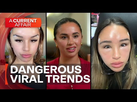 Influencer exposes dark side of social media beauty trends | A Current Affair