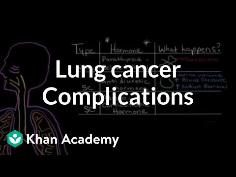 Lung cancer complications | Respiratory system diseases | NCLEX-RN | Khan Academy