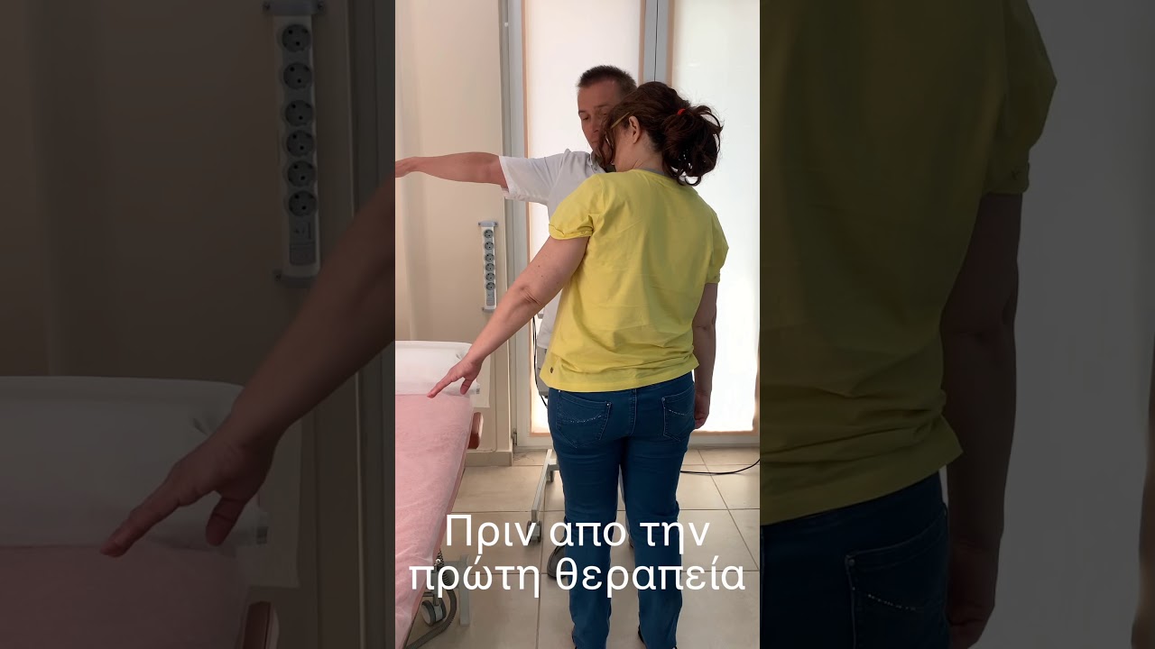 Κρουστικός Υπέρηχος σε ασβεστοποιό τενοντίτιδα ώμου.