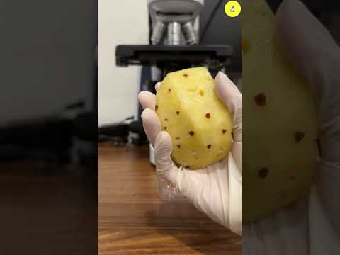 Pineapple juice vs BACTERIA under microscope | TULO - Microscope #shorts #bacteria