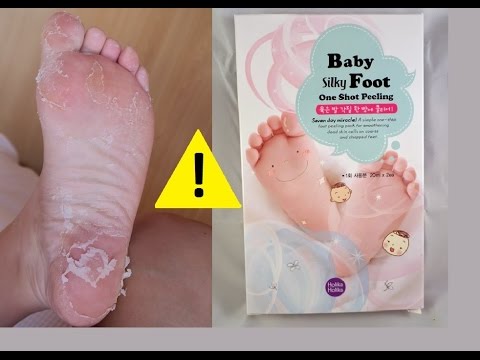 Buty ortopedyczne dla dzieci z koślawe zniekształcenie Orteke Kości na nogach. zatrzymać koślawa deformacja