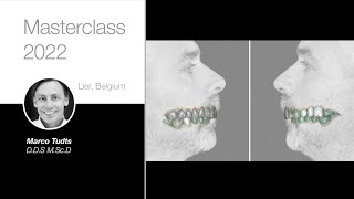 Masterclass Belgium, Lier 2022