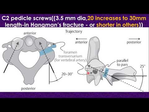 Artroza alinării durerii articulațiilor umărului